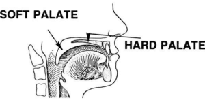 Bump On Roof Of Mouth – Grow Health