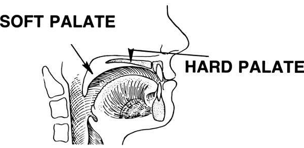 Bump On Roof Of Mouth palates