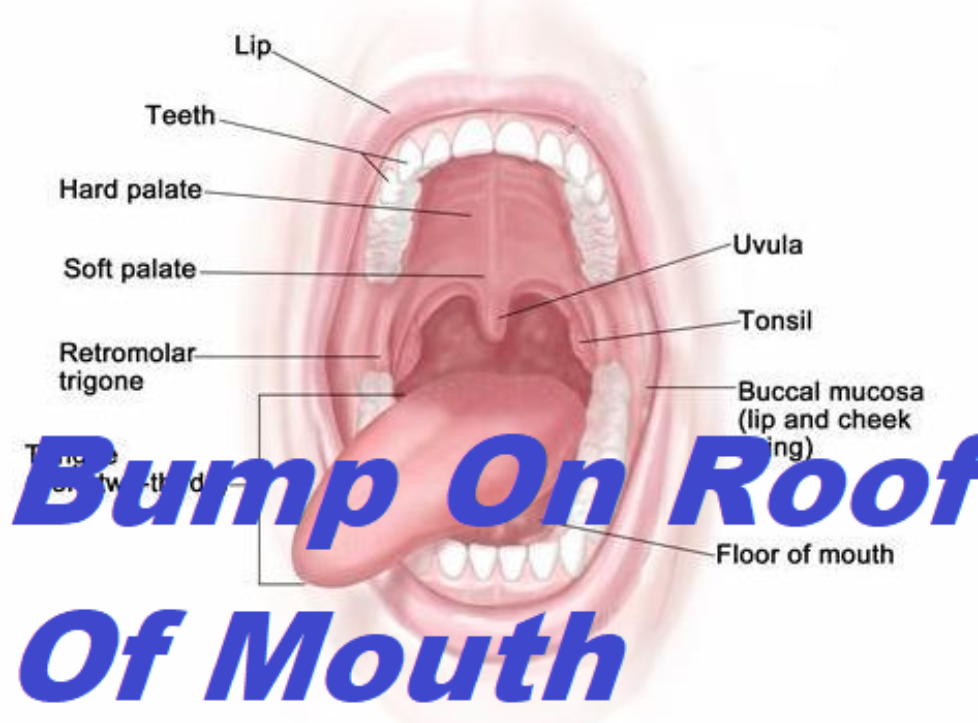 Bump On Roof Of Mouth Std Archives – Grow Health