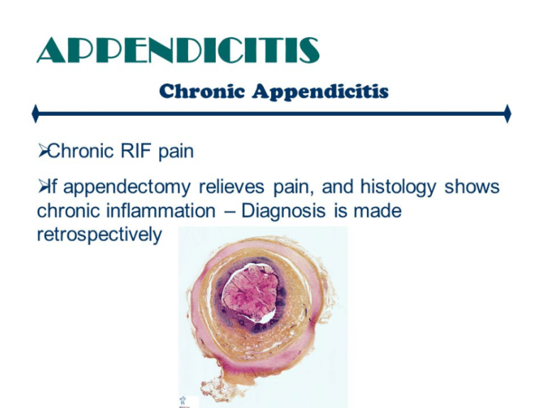 Chronic Appendicitis | Symptoms | Causes