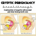 What Is A Cryptic Pregnancy? Explain