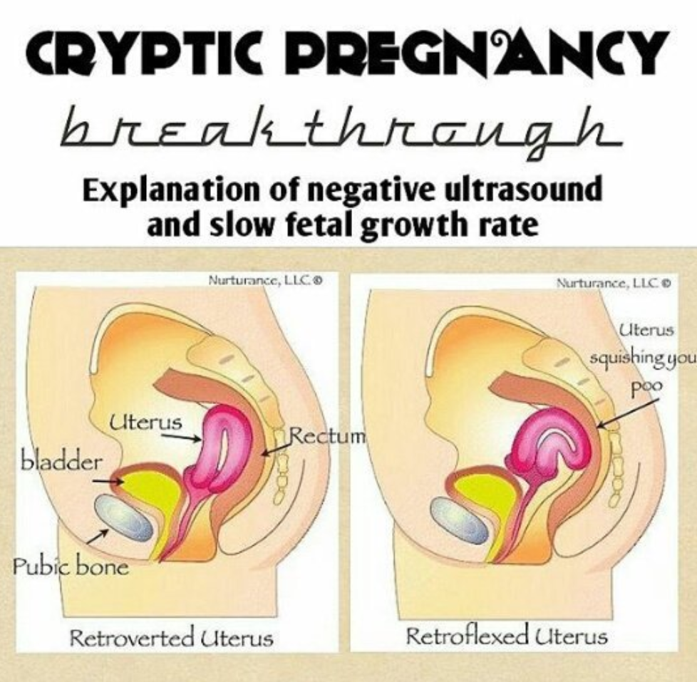 What Is A Cryptic Pregnancy? Explain Grow Health
