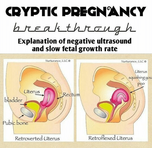 Cryptic Pregnancy Pictures