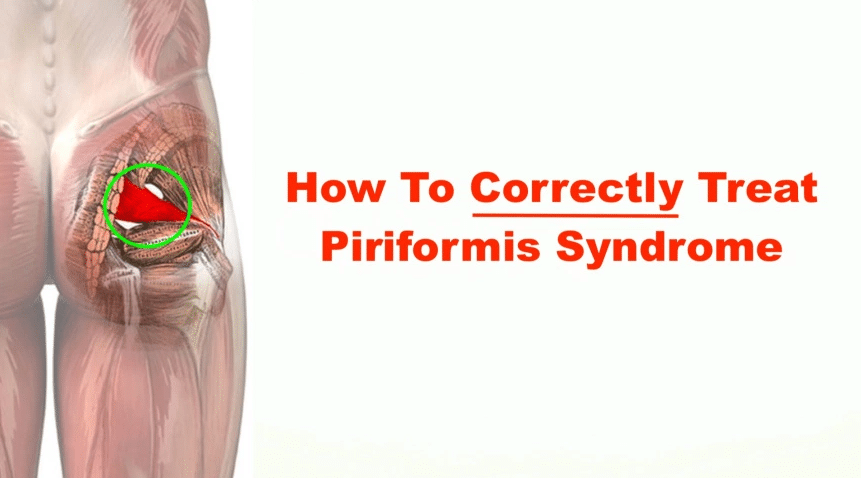 What Is Piriformis Syndrome Example Grow Health