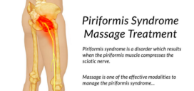 Piriformis Syndrome