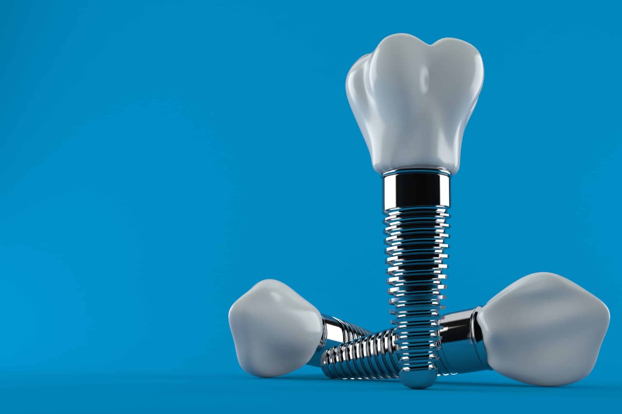 Dental implants provide a wider range of benefits