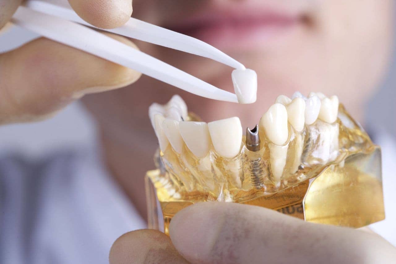 How Dental Implants Can Help Patients After Tragedy